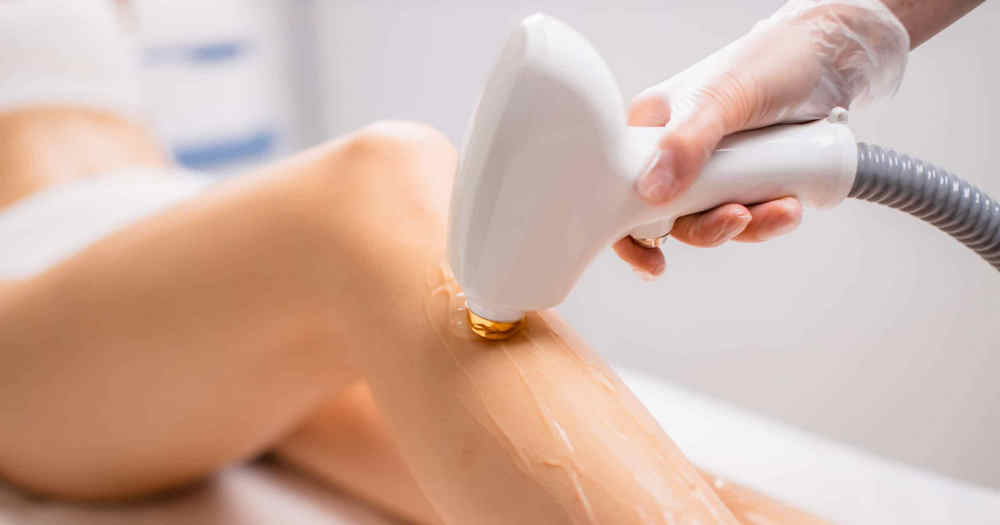 Wie viele Sitzungen zur Laser-Haarentfernung brauchst du?