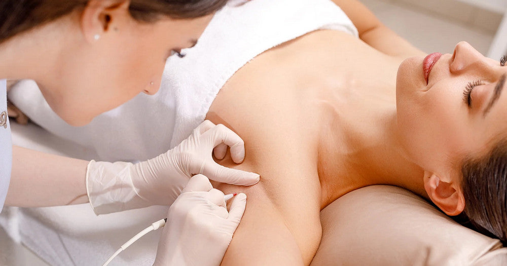 Tut die Haarentfernung durch Elektrolyse weh oder verursacht sie Krebs?