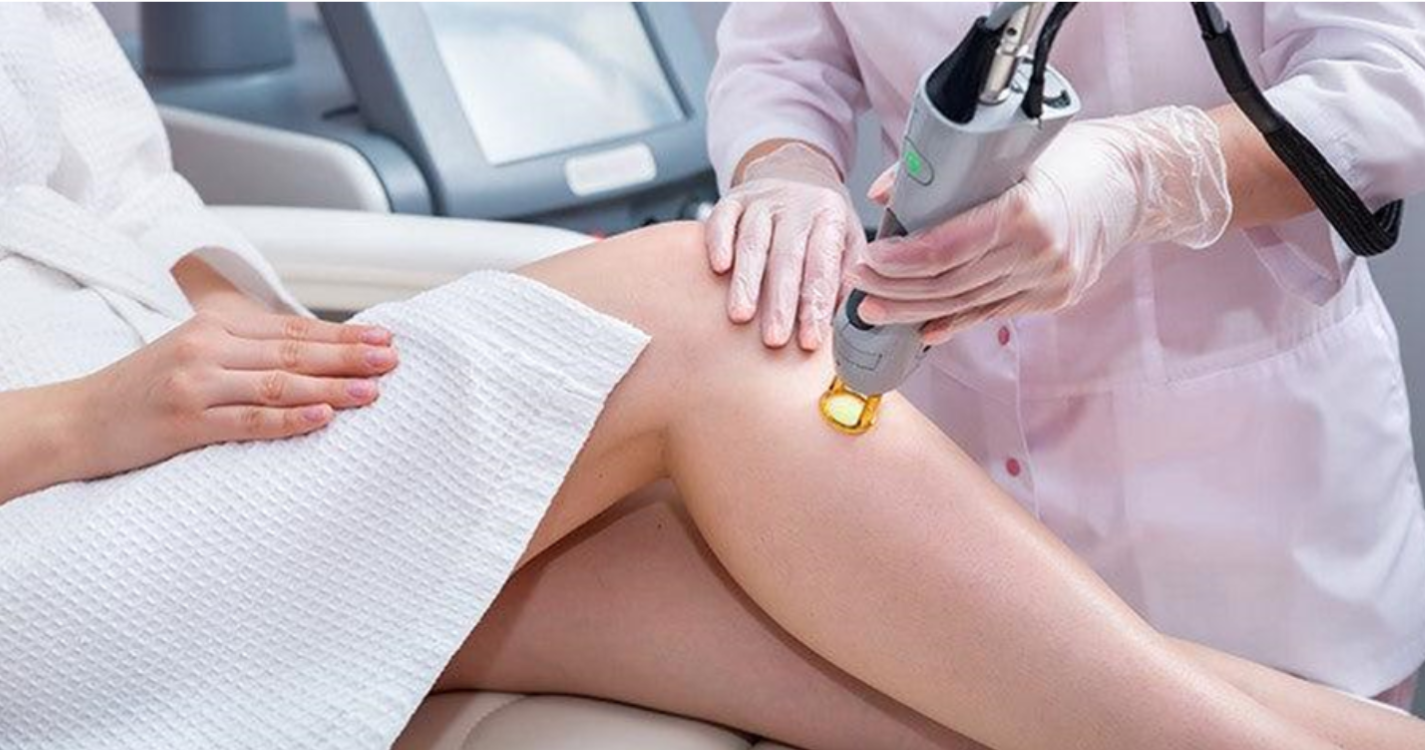 IPL vs. Alexandrit Laser-Haarentfernung