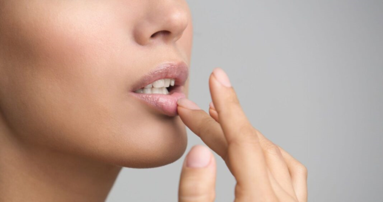 Wie wird man die Oberlippenhaare los?