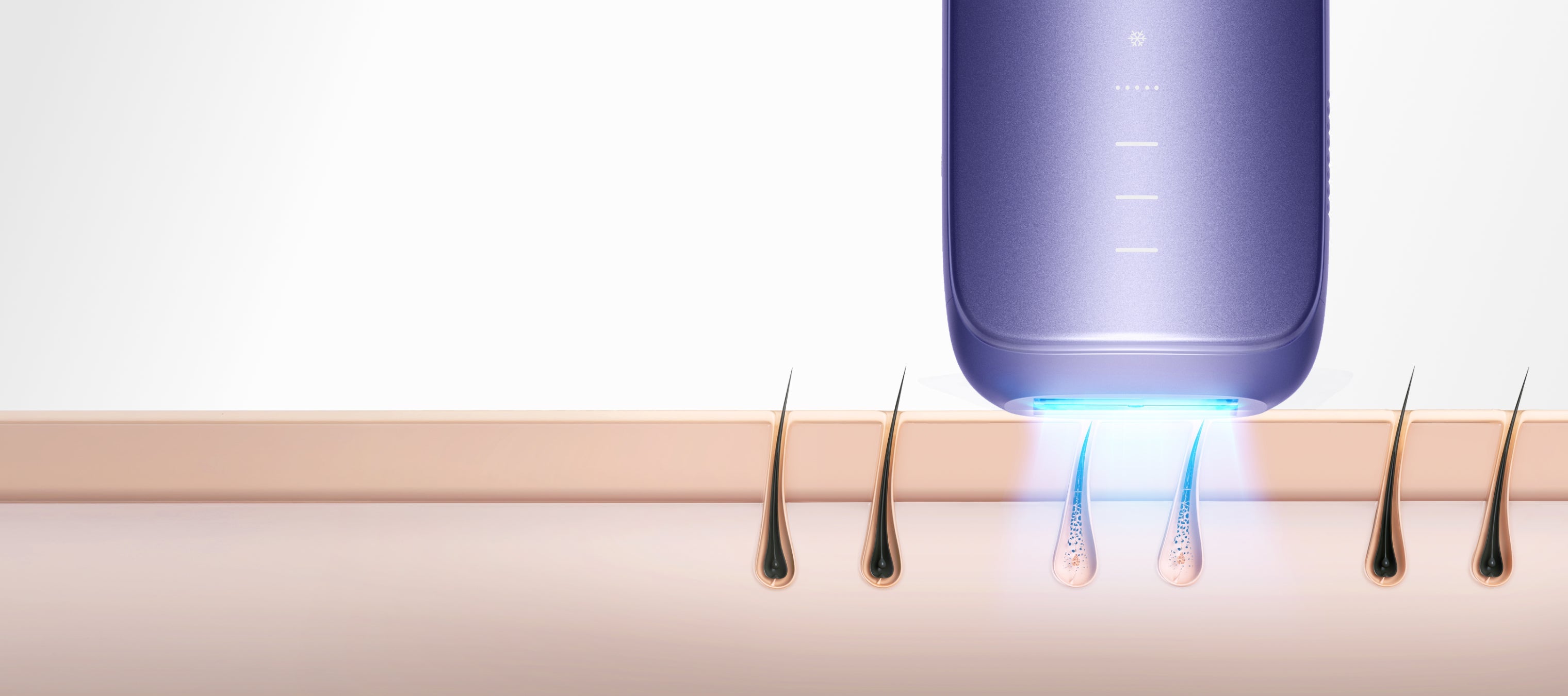 Top 6 IPL-Haarentfernungsgeräte für zu Hause 2025