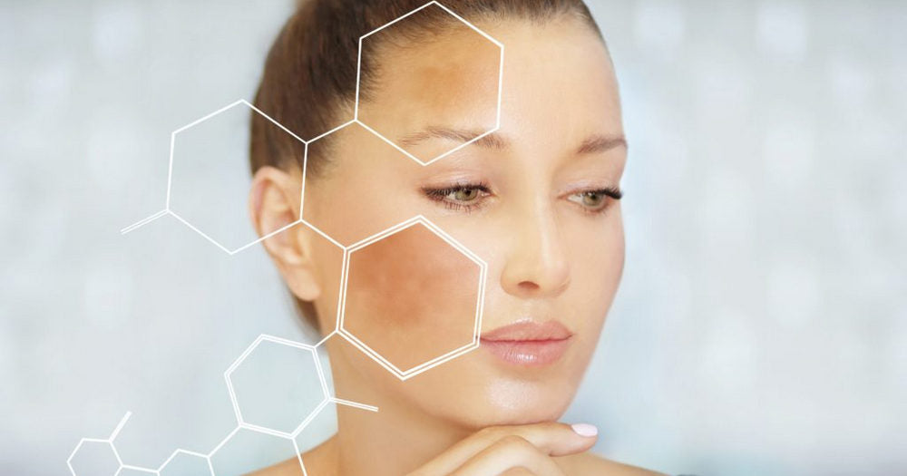 Wie behandelt man Hyperpigmentierung nach einer Laser-Haarentfernung?