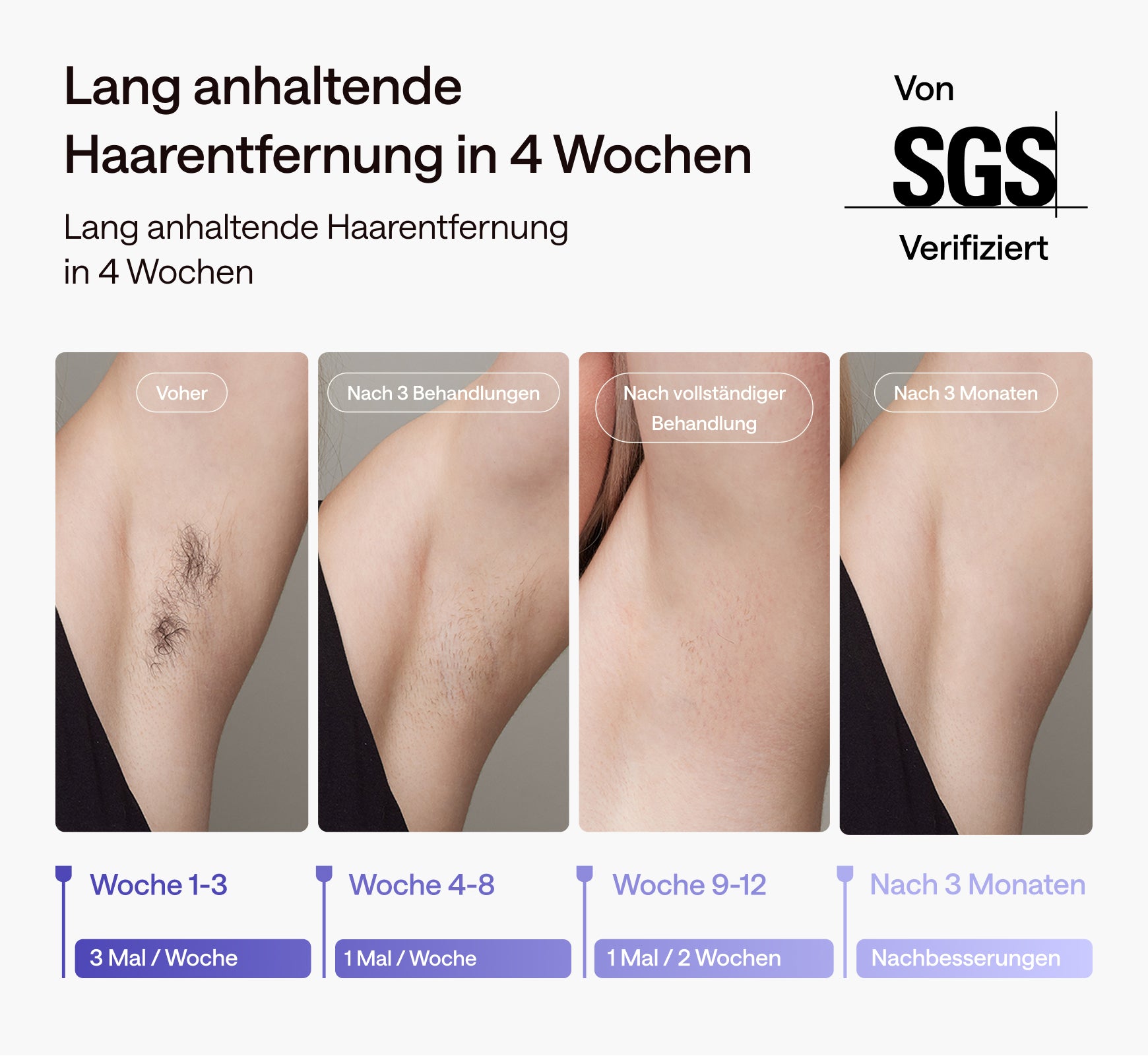 Ulike Air 3 Eiskühl-IPL-Haarentfernungsgerät für zu Hause