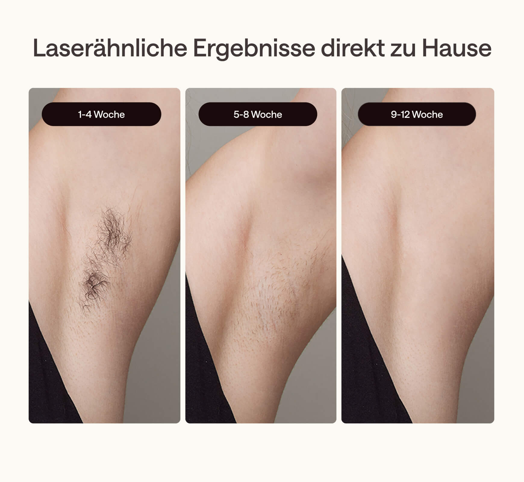 Ulike Air 3 Eiskühl-IPL-Haarentfernungsgerät für zu Hause