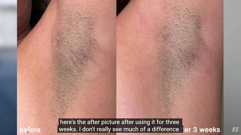 Vergleich Achselhöhlen