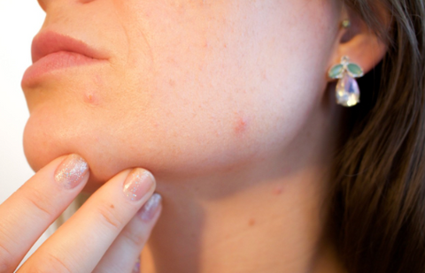 Nebenwirkungen der IPL-Haarentfernung