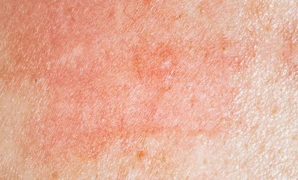 Waxing aufhören solltest