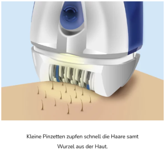Wahl des richtigen Epiliergeräts