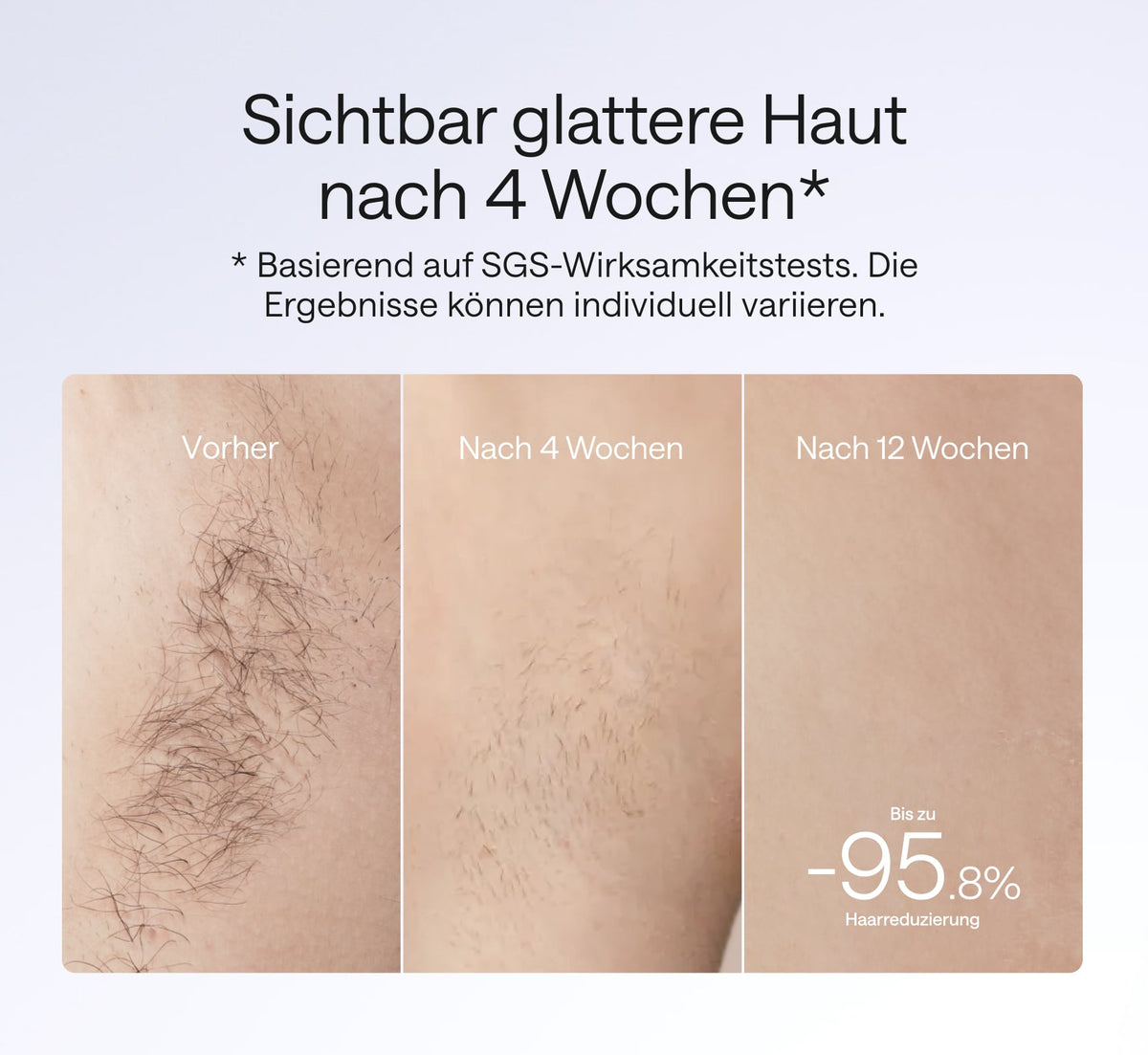 ulike-Air-4-ipl-haarentferner-vorher-nachher-4-wochen-ergebnis-sgs