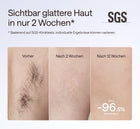 ulike-air-10-pro-glattere-haut-in-2-wochen-ipl-geraet-fuer-zuhause