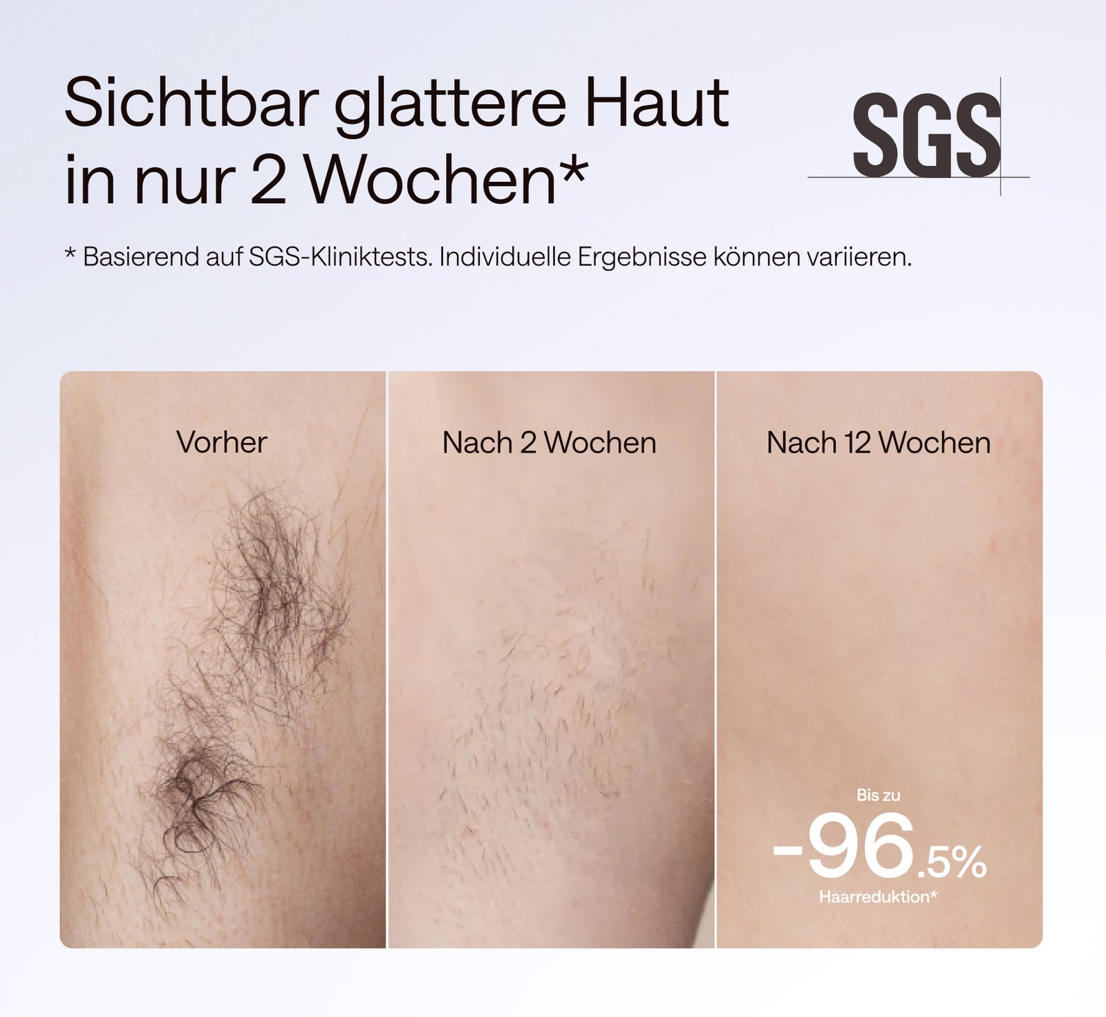 ulike-air-10-pro-glattere-haut-in-2-wochen-ipl-geraet-fuer-zuhause